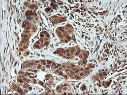 Invitrogen FBXO21 Monoclonal Antibody (OTI2C7) 100 &mu;L; Unconjugated:Antibodies,