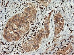 Invitrogen FBXO21 Monoclonal Antibody (OTI2C7) 100 &mu;L; Unconjugated:Antibodies,