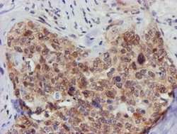 Invitrogen FBXO21 Monoclonal Antibody (OTI5H4) 100 &mu;L | Buy Online | Invitrogen&trade; | Fisher Scientific