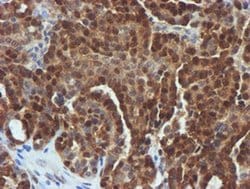 Invitrogen FBXO21 Monoclonal Antibody (OTI5H4) 100 &mu;L | Buy Online | Invitrogen&trade; | Fisher Scientific