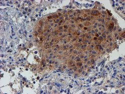 Invitrogen LECT2 Monoclonal Antibody (OTI2A11) 100 &mu;L; Unconjugated:Antibodies,