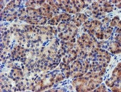 Invitrogen LECT2 Monoclonal Antibody (OTI2A11) 100 &mu;L; Unconjugated:Antibodies,