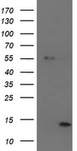 Invitrogen LECT2 Monoclonal Antibody (OTI2A11) 100 &mu;L; Unconjugated:Antibodies,