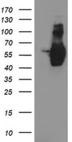 Invitrogen GOLPH2 Monoclonal Antibody (OTI4B12) 100 &mu;L; Unconjugated:Antibodies,