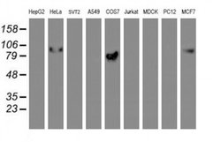 Invitrogen GOLPH2 Monoclonal Antibody (OTI4B12) 100 &mu;L; Unconjugated:Antibodies,