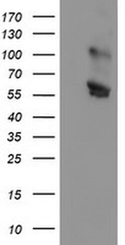 Invitrogen GOLPH2 Monoclonal Antibody (OTI6C9) 100 &mu;L | Buy Online | Invitrogen&trade; | Fisher Scientific