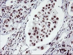 Invitrogen RNF113B Monoclonal Antibody (OTI2C10) 100 &mu;L; Unconjugated:Antibodies,
