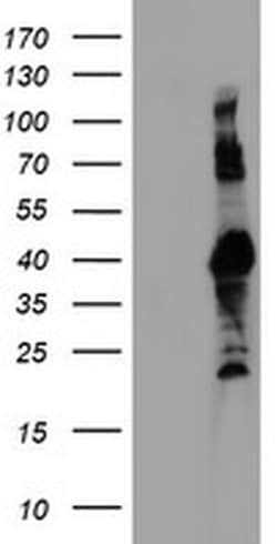 Invitrogen RNF113B Monoclonal Antibody (OTI2C10) 100 &mu;L; Unconjugated:Antibodies,