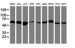 Invitrogen RNF113B Monoclonal Antibody (OTI2C10) 100 &mu;L; Unconjugated:Antibodies,