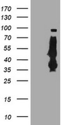 Invitrogen SERPINB6 Monoclonal Antibody (OTI1C5) 100 &mu;L; Unconjugated:Antibodies,