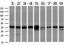 Invitrogen SERPINB6 Monoclonal Antibody (OTI1C5) 100 &mu;L; Unconjugated:Antibodies,