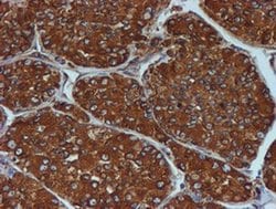 Invitrogen ERP72 Monoclonal Antibody (OTI2B9) 100 &mu;L; Unconjugated:Antibodies,