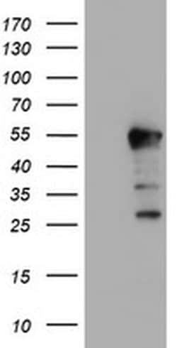Invitrogen ERI1 Monoclonal Antibody (OTI1B3) 100 &mu;L; Unconjugated:Antibodies,