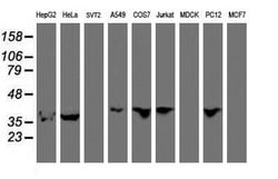 Invitrogen ERI1 Monoclonal Antibody (OTI1B3) 100 &mu;L; Unconjugated:Antibodies,