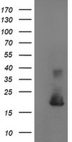 Invitrogen Cystatin S Monoclonal Antibody (OTI2H10) 100 μL; Unconjugated:Antibodies,