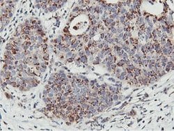 NMT2 Monoclonal Antibody (OTI1G3):Antibodies, Monoclonal