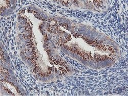 NMT2 Monoclonal Antibody (OTI1G3):Antibodies, Monoclonal