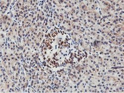 NMT2 Monoclonal Antibody (OTI1G3):Antibodies, Monoclonal