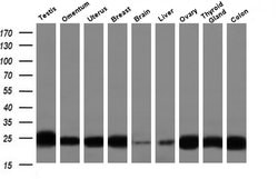 Invitrogen J Chain Monoclonal Antibody (OTI3B3) 100 &mu;L; Unconjugated:Antibodies,