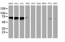 Invitrogen NMT2 Monoclonal Antibody (OTI2A5) 100 &mu;L; Unconjugated:Antibodies,