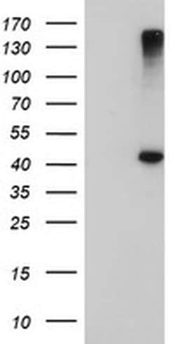 Invitrogen AGPAT5 Monoclonal Antibody (OTI1D12) 100 &mu;L | Buy Online | Invitrogen&trade; | Fisher Scientific