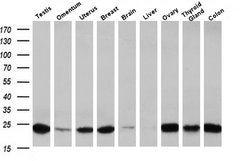 Invitrogen J Chain Monoclonal Antibody (OTI3H7) 100 &mu;L; Unconjugated:Antibodies,