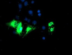 Invitrogen Kir3.1 (KCNJ3) Monoclonal Antibody (OTI1G3) 100 &mu;L; Unconjugated:Antibodies,