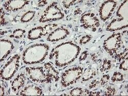 Invitrogen Kir3.1 (KCNJ3) Monoclonal Antibody (OTI1G3) 100 &mu;L; Unconjugated:Antibodies,