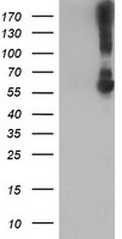 Invitrogen Kir3.1 (KCNJ3) Monoclonal Antibody (OTI1G3) 100 &mu;L; Unconjugated:Antibodies,
