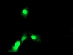 Invitrogen EXOSC7 Monoclonal Antibody (OTI2E5) 100 &mu;L; Unconjugated:Antibodies,