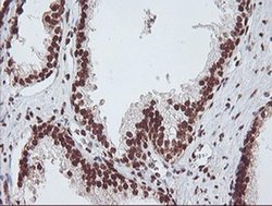 EXOSC7 Monoclonal Antibody (OTI1G8):Antibodies, Monoclonal