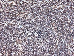 EXOSC7 Monoclonal Antibody (OTI1G8):Antibodies, Monoclonal