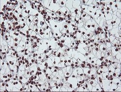 EXOSC7 Monoclonal Antibody (OTI1G8):Antibodies, Monoclonal
