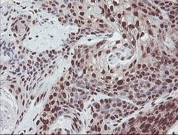 EXOSC7 Monoclonal Antibody (OTI1G8):Antibodies, Monoclonal