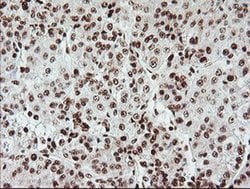 EXOSC7 Monoclonal Antibody (OTI1G8):Antibodies, Monoclonal
