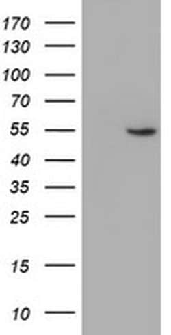 Invitrogen ALG2 Monoclonal Antibody (OTI3C2) 100 &mu;L; Unconjugated:Antibodies,