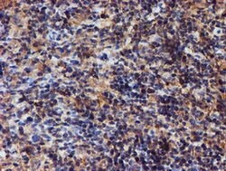 Invitrogen Iduronate 2 Sulfatase Monoclonal Antibody (OTI1D9) 100 &mu;L | Buy Online | Invitrogen&trade; | Fisher Scientific