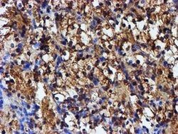 Invitrogen Iduronate 2 Sulfatase Monoclonal Antibody (OTI1D9) 100 &mu;L | Buy Online | Invitrogen&trade; | Fisher Scientific
