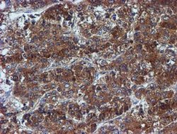 Invitrogen Iduronate 2 Sulfatase Monoclonal Antibody (OTI1D9) 100 &mu;L | Buy Online | Invitrogen&trade; | Fisher Scientific