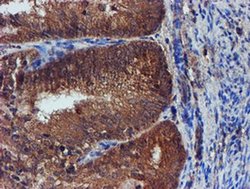 Invitrogen Iduronate 2 Sulfatase Monoclonal Antibody (OTI1D9) 100 &mu;L | Buy Online | Invitrogen&trade; | Fisher Scientific