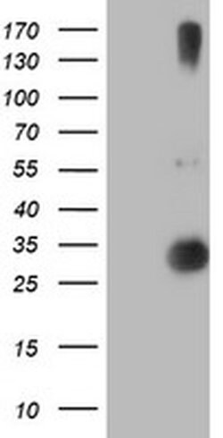 Invitrogen RFXANK Monoclonal Antibody (OTI3E7) 100 &mu;L | Buy Online | Invitrogen&trade; | Fisher Scientific