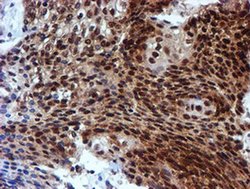 Invitrogen RUVBL2 Monoclonal Antibody (OTI1H10) 100 &mu;L; Unconjugated:Antibodies,