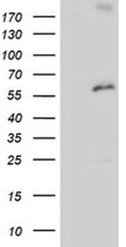 Invitrogen PSMD3 Monoclonal Antibody (OTI2C2) 100 &mu;L; Unconjugated:Antibodies,