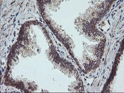 Invitrogen GADD34 Monoclonal Antibody (OTI4F1) 100 &mu;L; Unconjugated:Antibodies,