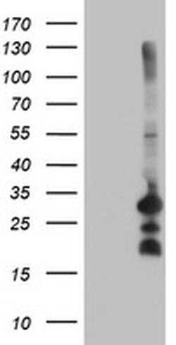 Invitrogen REEP2 Monoclonal Antibody (OTI2B7) 100 &mu;L | Buy Online | Invitrogen&trade; | Fisher Scientific