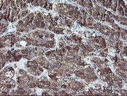 Invitrogen REEP2 Monoclonal Antibody (OTI2C7) 100 &mu;L; Unconjugated:Antibodies,