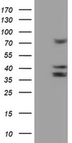 Invitrogen CYP2B6 Monoclonal Antibody (OTI3D5) 100 &mu;L; Unconjugated:Antibodies,