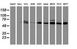Invitrogen CYP2B6 Monoclonal Antibody (OTI3D5) 100 &mu;L; Unconjugated:Antibodies,