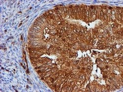 Invitrogen PSMB9 Monoclonal Antibody (OTI1C4) 100 &mu;L; Unconjugated:Antibodies,