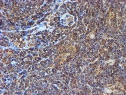 Invitrogen PSMB9 Monoclonal Antibody (OTI1C4) 100 &mu;L; Unconjugated:Antibodies,